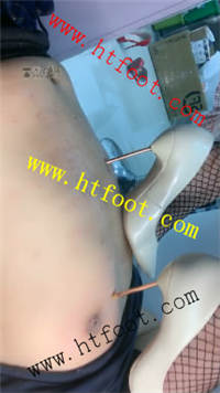 h4ltt0a4pto.jpg