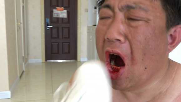 hiejeto3tcp.jpg