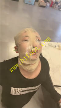 0exo2zoeuu2.jpg